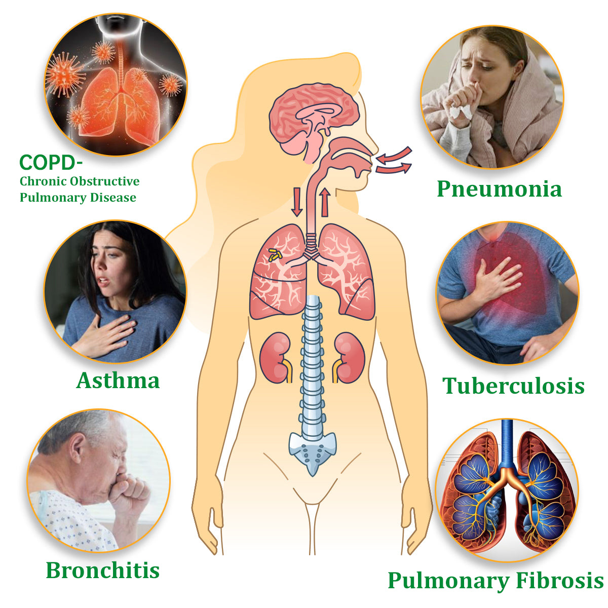 ✅Official Store:Ourlyard® Herbal Lung Cleansing Inhaler 👑(💝 Cough, wheezing, shortness of breath, sputum, stuffy nose, bronchitis, bronchitis, allergy symptoms, lung discomfort💝)