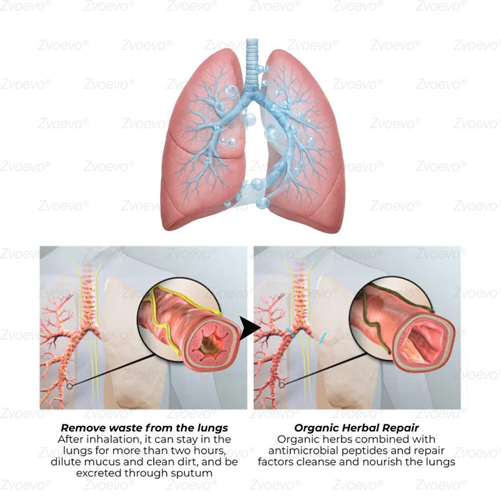 ✅UK Owned and Operated：Zvoevo® Botanical Mullein Lung Cleanse Diffuser (💝 Cough, wheezing, shortness of breath, sputum, stuffy nose, bronchitis, bronchitis, allergy symptoms, lung discomfort💝)