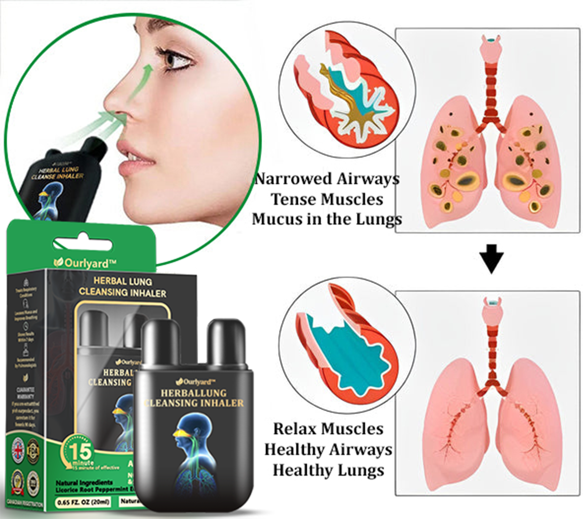 ✅Official Store:Ourlyard® Herbal Lung Cleansing Inhaler 👑(💝 Cough, wheezing, shortness of breath, sputum, stuffy nose, bronchitis, bronchitis, allergy symptoms, lung discomfort💝)