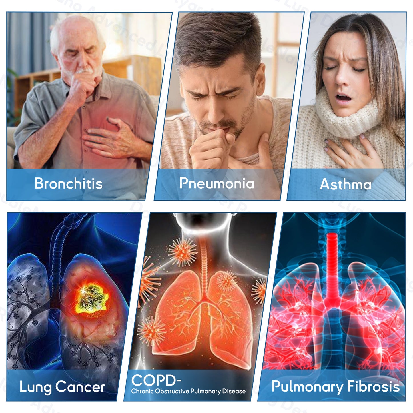 ✅𝐔𝐩𝐠𝐫𝐚𝐝𝐞𝐝 𝐯𝐞𝐫𝐬𝐢𝐨𝐧:𝐎𝐮𝐫𝐥𝐲𝐚𝐫𝐝®  𝐃𝐨𝐮𝐛𝐥𝐞𝐍𝐚𝐧𝐨 𝐀𝐝𝐯𝐚𝐧𝐜𝐞𝐝 𝐋𝐮𝐧𝐠 𝐃𝐞𝐭𝐨𝐱 𝐑𝐞𝐥𝐢𝐞𝐟 𝐏𝐚𝐭𝐜𝐡(💝 Cough, wheezing, shortness of breath, sputum, stuffy nose, bronchitis, bronchitis, allergy symptoms, lung discomfort💝)