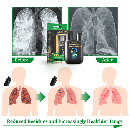 ✅Official Store:Ourlyard® Herbal Lung Cleansing Inhaler 👑(💝 Cough, wheezing, shortness of breath, sputum, stuffy nose, bronchitis, bronchitis, allergy symptoms, lung discomfort💝)